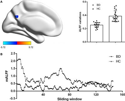 Disturbances of Dynamic Function in Patients With Bipolar Disorder I and Its Relationship With Executive-Function Deficit